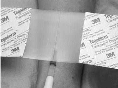 3M™ TEGADERM™ HP (HOLDING POWER) TRANSPARENT FILM DRESSING