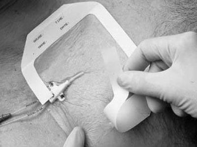 3M™ TEGADERM™ TRANSPARENT FILM DRESSING FRAME STYLE