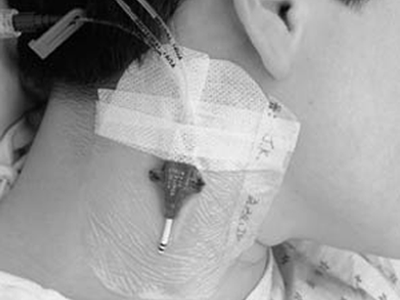 3M™ TEGADERM™ IV TRANSPARENT FILM DRESSING WITH BORDER